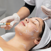 Chemical Peels