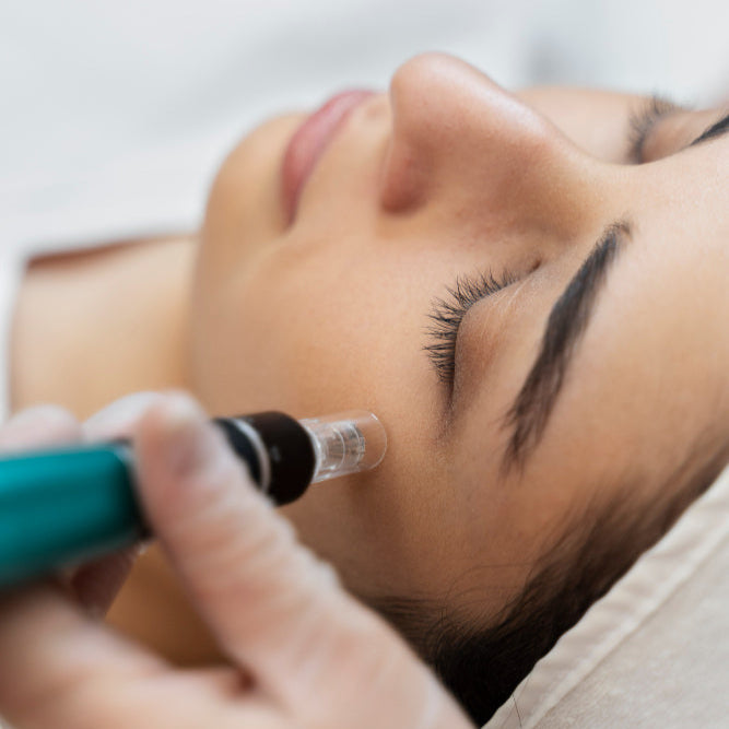 Microneedling