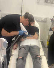 Tattoo Removal