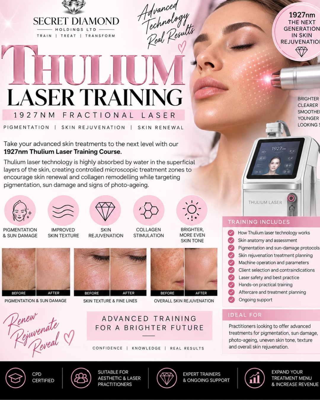 Thulium Laser Training