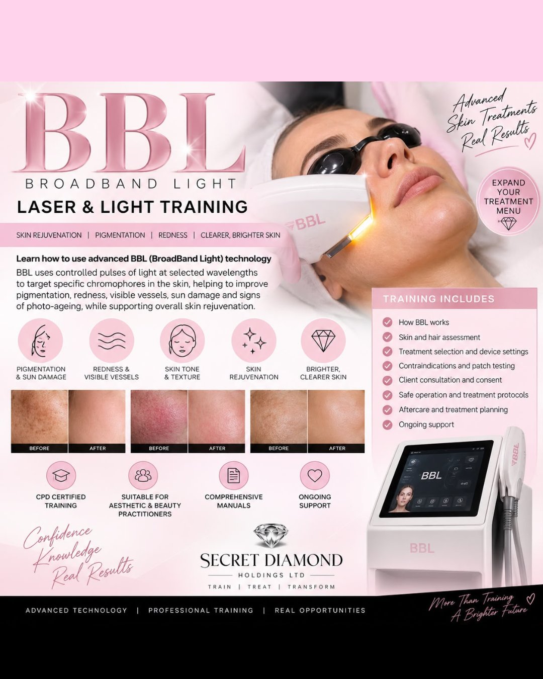 BBL Laser & Light Training